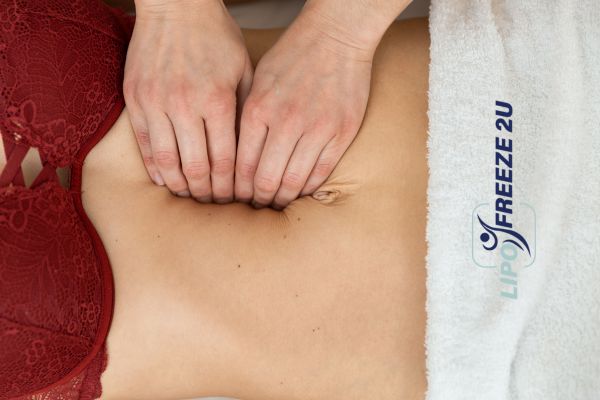diastasis recti treatment St Neots