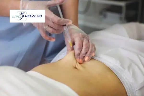Fat Dissolving Injections St Neots & Weight loss medication