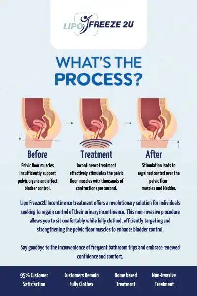 Diagram of how incontinence treatment St Neots works.