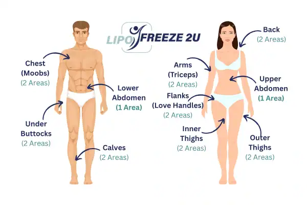 Areas you can have fat freezing treatment St Neots