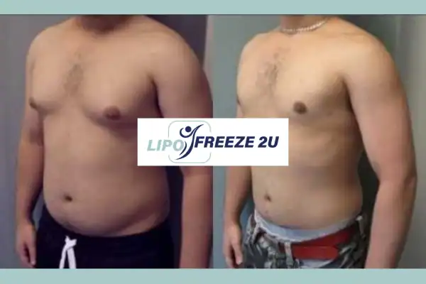 How Long Does It Take to See Results St Neots?
