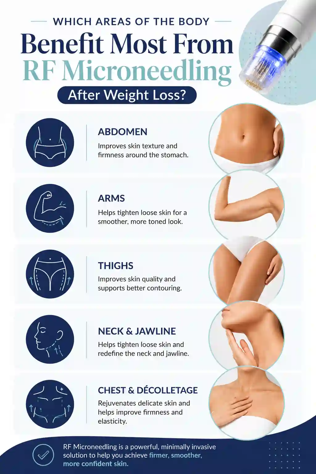 Which Areas of the Body Benefit Most From RF Microneedling After Weight Loss St Neots